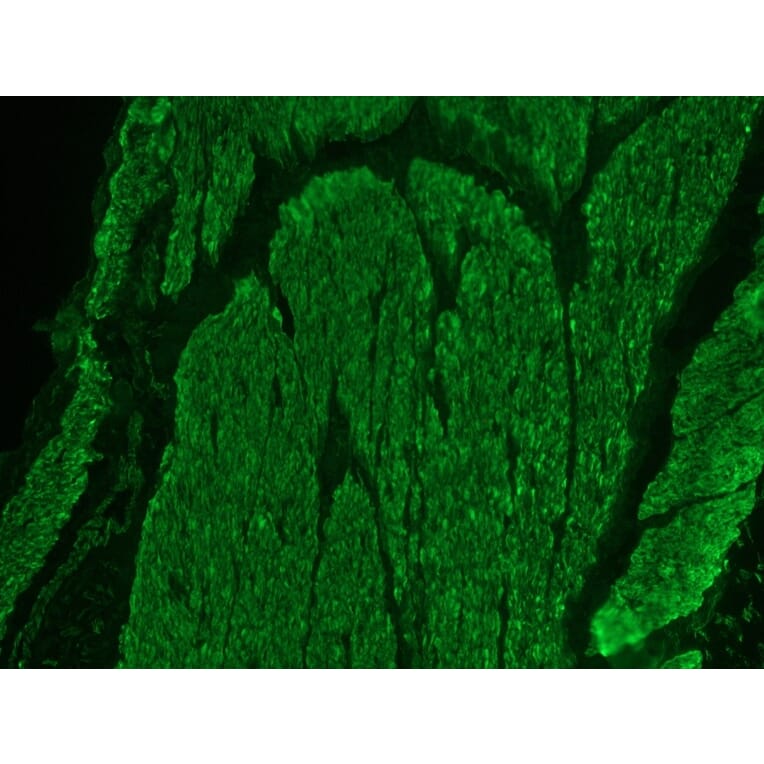Immunohistochemistry - Anti-Desmin Antibody (A115569) - Antibodies.com