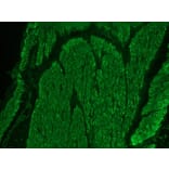 Immunohistochemistry - Anti-Desmin Antibody (A115569) - Antibodies.com