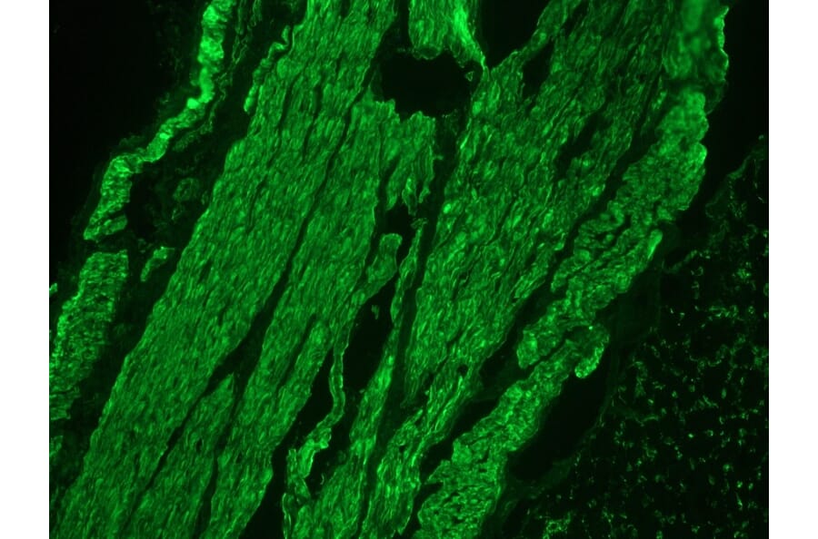 Immunohistochemistry - Anti-Desmin Antibody (A115569) - Antibodies.com