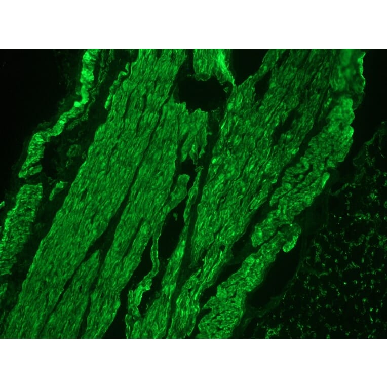 Immunohistochemistry - Anti-Desmin Antibody (A115569) - Antibodies.com