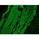 Immunohistochemistry - Anti-Desmin Antibody (A115569) - Antibodies.com