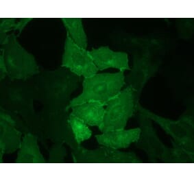 Immunocytochemistry - Anti-CD62E Antibody [UZ6] (A115576) - Antibodies.com