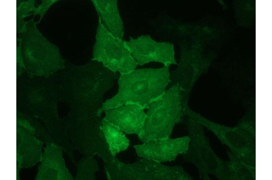 Immunocytochemistry - Anti-CD62E Antibody [UZ6] (A115576) - Antibodies.com