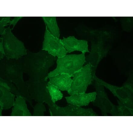 Immunocytochemistry - Anti-CD62E Antibody [UZ6] (A115576) - Antibodies.com