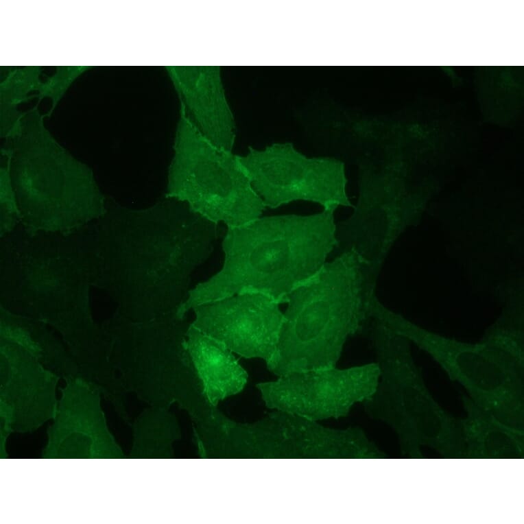 Immunocytochemistry - Anti-CD62E Antibody [UZ6] (A115576) - Antibodies.com