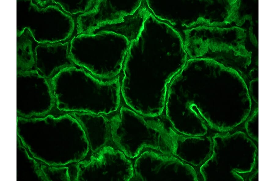 Immunohistochemistry - Anti-Integrin alpha 6A Antibody [NKI-GoH3] (A115600) - Antibodies.com