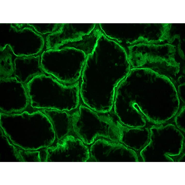 Immunohistochemistry - Anti-Integrin alpha 6A Antibody [NKI-GoH3] (A115600) - Antibodies.com
