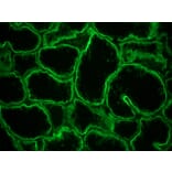 Immunohistochemistry - Anti-Integrin alpha 6A Antibody [NKI-GoH3] (A115600) - Antibodies.com