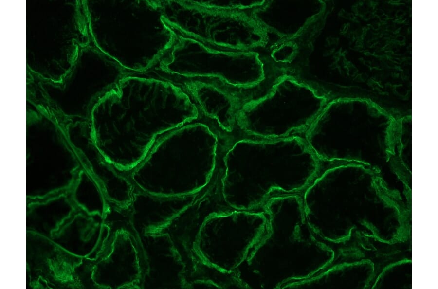Immunohistochemistry - Anti-Integrin alpha 6A Antibody [NKI-GoH3] (A115600) - Antibodies.com
