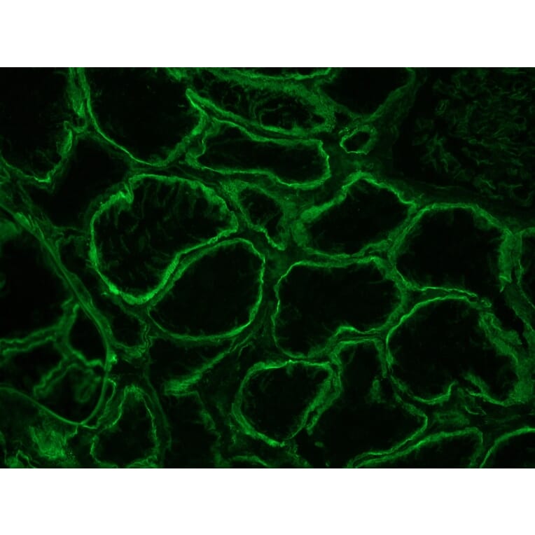 Immunohistochemistry - Anti-Integrin alpha 6A Antibody [NKI-GoH3] (A115600) - Antibodies.com