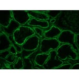 Immunohistochemistry - Anti-Integrin alpha 6A Antibody [NKI-GoH3] (A115600) - Antibodies.com