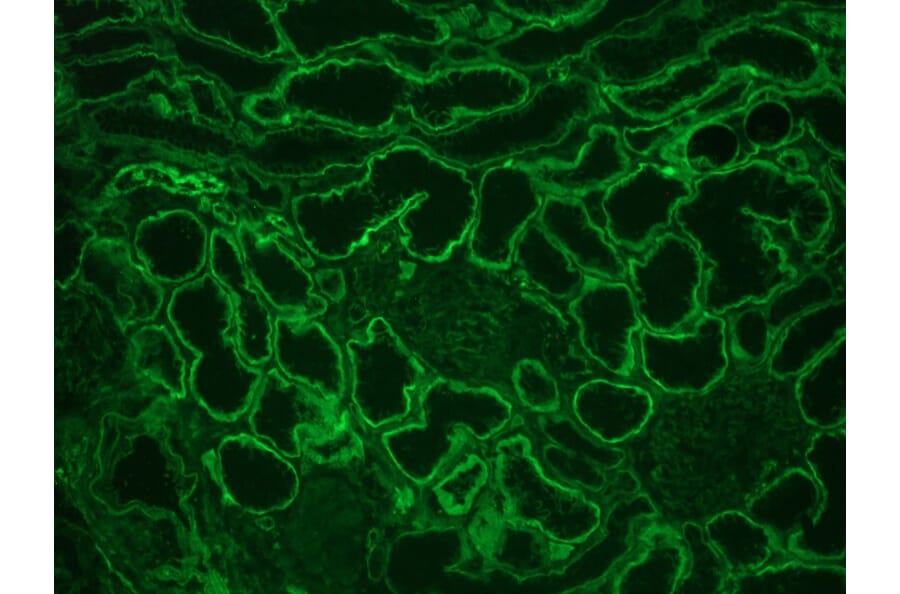 Immunohistochemistry - Anti-Integrin alpha 6A Antibody [NKI-GoH3] (A115600) - Antibodies.com