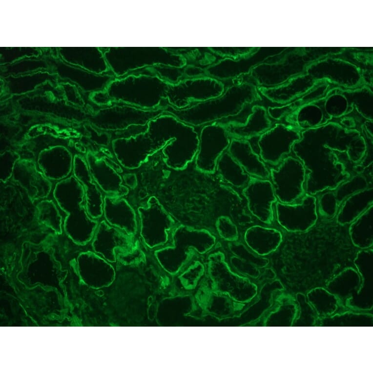Immunohistochemistry - Anti-Integrin alpha 6A Antibody [NKI-GoH3] (A115600) - Antibodies.com