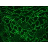 Immunohistochemistry - Anti-Integrin alpha 6A Antibody [NKI-GoH3] (A115600) - Antibodies.com