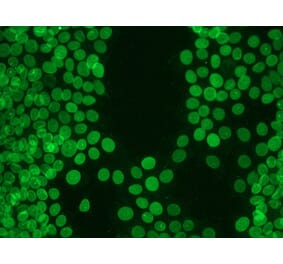 Immunohistochemistry - Anti-Lamin B1 Antibody [119D5-F1] (A115608) - Antibodies.com