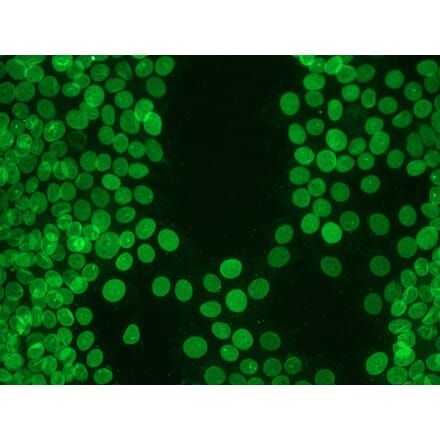 Immunohistochemistry - Anti-Lamin B1 Antibody [119D5-F1] (A115608) - Antibodies.com
