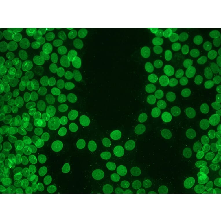 Immunohistochemistry - Anti-Lamin B1 Antibody [119D5-F1] (A115608) - Antibodies.com
