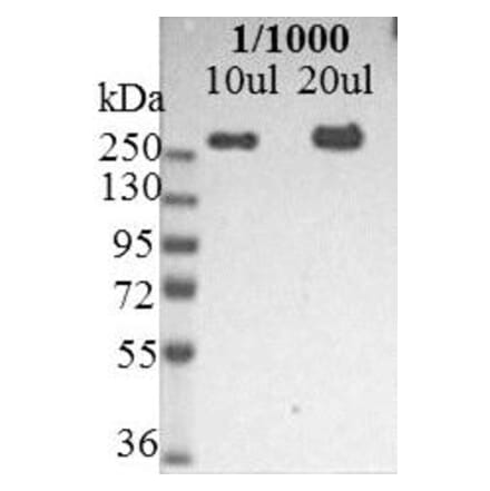 Western Blot - Anti-Nestin Antibody [10C2] (A115620) - Antibodies.com