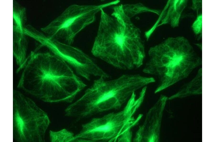 Immunohistochemistry - Anti-Nestin Antibody [10C2] (A115620) - Antibodies.com
