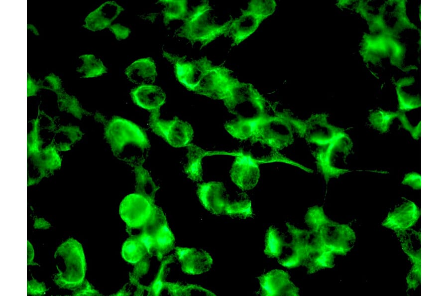 Immunohistochemistry - Anti-Nestin Antibody [10C2] (A115620) - Antibodies.com