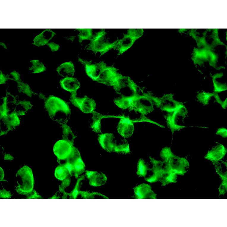 Immunohistochemistry - Anti-Nestin Antibody [10C2] (A115620) - Antibodies.com