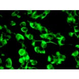 Immunohistochemistry - Anti-Nestin Antibody [10C2] (A115620) - Antibodies.com