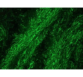Immunofluorescence - Anti-NF-M Antibody [RNF403] (A115622) - Antibodies.com