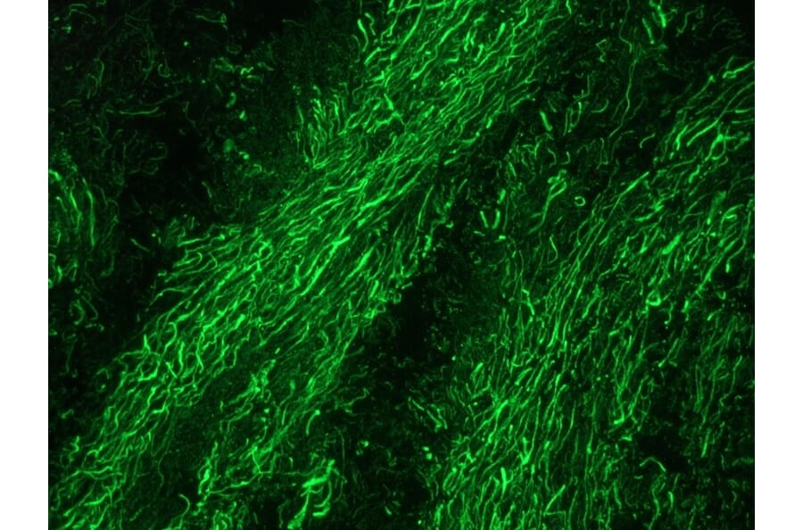 Immunofluorescence - Anti-NF-M Antibody [RNF403] (A115622) - Antibodies.com