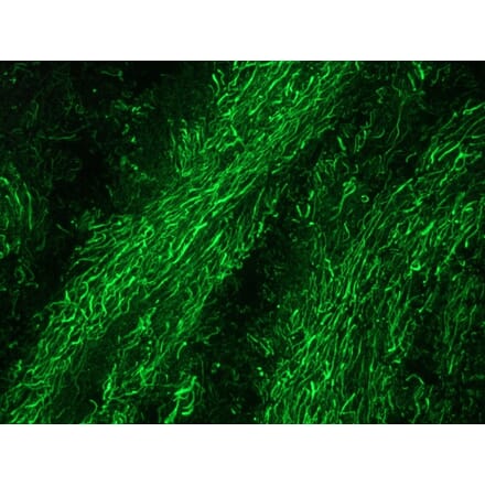 Immunofluorescence - Anti-NF-M Antibody [RNF403] (A115622) - Antibodies.com