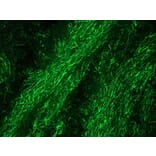 Immunofluorescence - Anti-NF-M Antibody [RNF403] (A115622) - Antibodies.com