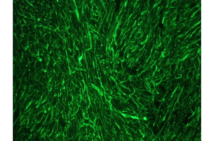 Immunofluorescence - Anti-NF-M Antibody [RNF403] (A115622) - Antibodies.com