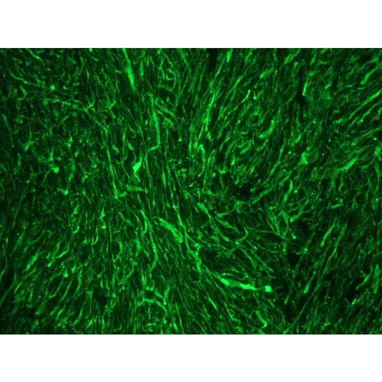 Immunofluorescence - Anti-NF-M Antibody [RNF403] (A115622) - Antibodies.com