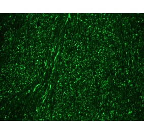 Immunohistochemistry - Anti-NF-M Antibody [RNF406] (A115623) - Antibodies.com