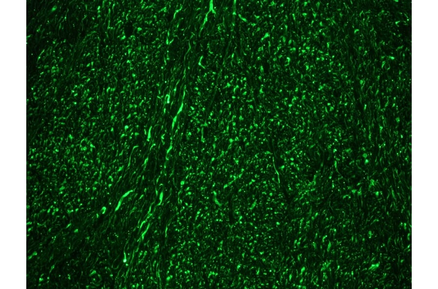 Immunohistochemistry - Anti-NF-M Antibody [RNF406] (A115623) - Antibodies.com