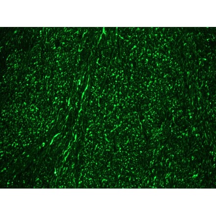 Immunohistochemistry - Anti-NF-M Antibody [RNF406] (A115623) - Antibodies.com
