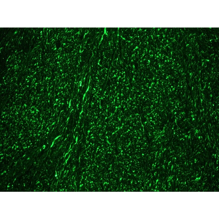 Immunohistochemistry - Anti-NF-M Antibody [RNF406] (A115623) - Antibodies.com