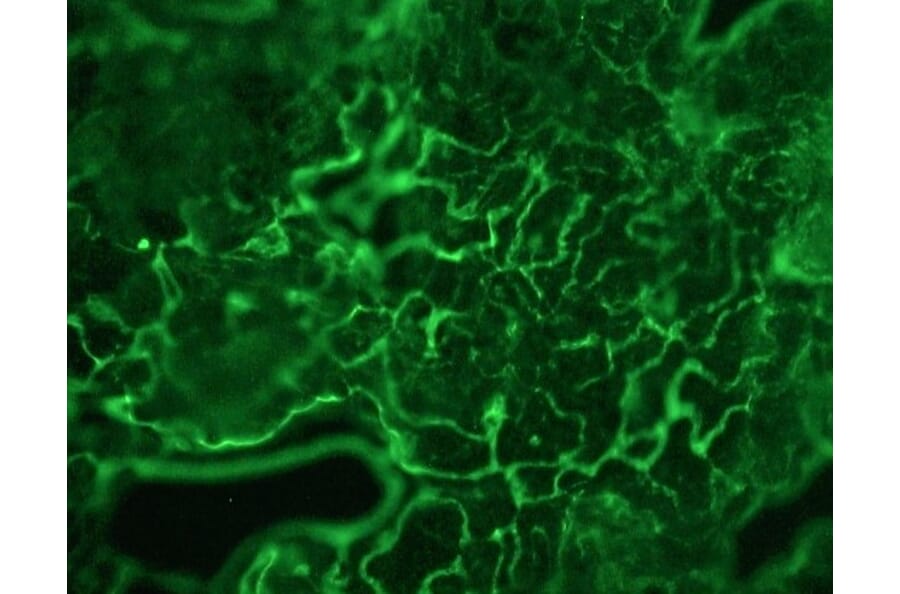 Immunohistochemistry - Anti-Plakophilin 3 Antibody [12B11F8] (A115638) - Antibodies.com