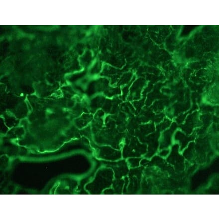 Immunohistochemistry - Anti-Plakophilin 3 Antibody [12B11F8] (A115638) - Antibodies.com