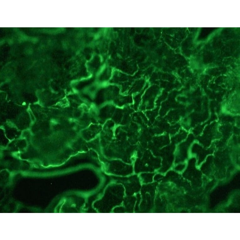 Immunohistochemistry - Anti-Plakophilin 3 Antibody [12B11F8] (A115638) - Antibodies.com