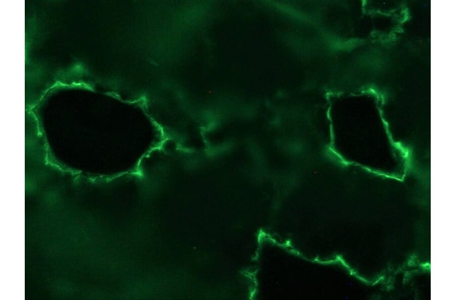Immunohistochemistry - Anti-Plakophilin 3 Antibody [12B11F8] (A115638) - Antibodies.com