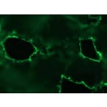 Immunohistochemistry - Anti-Plakophilin 3 Antibody [12B11F8] (A115638) - Antibodies.com