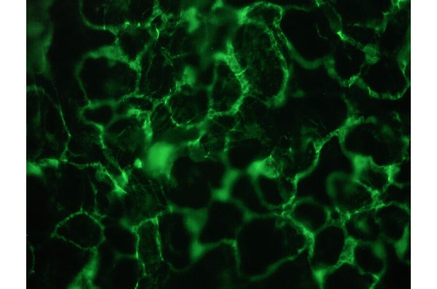 Immunohistochemistry - Anti-Plakophilin 3 Antibody [12B11F8] (A115638) - Antibodies.com