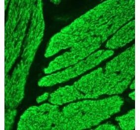 Immunohistochemistry - Anti-Smoothelin Antibody [R4A] (A115642) - Antibodies.com