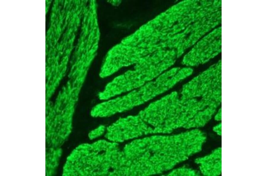 Immunohistochemistry - Anti-Smoothelin Antibody [R4A] (A115642) - Antibodies.com