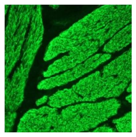 Immunohistochemistry - Anti-Smoothelin Antibody [R4A] (A115642) - Antibodies.com