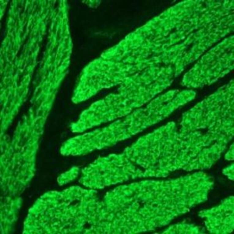 Immunohistochemistry - Anti-Smoothelin Antibody [R4A] (A115642) - Antibodies.com