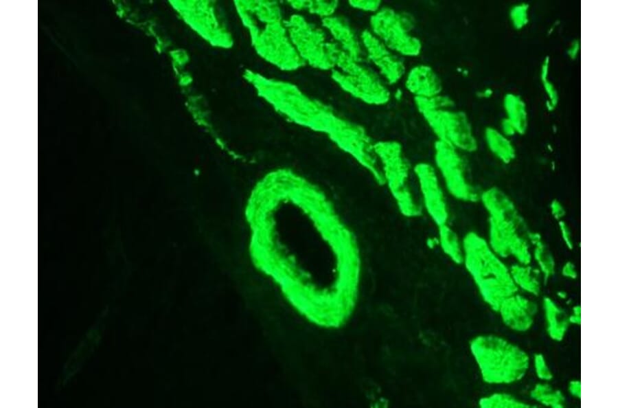 Immunohistochemistry - Anti-Smoothelin Antibody [R4A] (A115642) - Antibodies.com