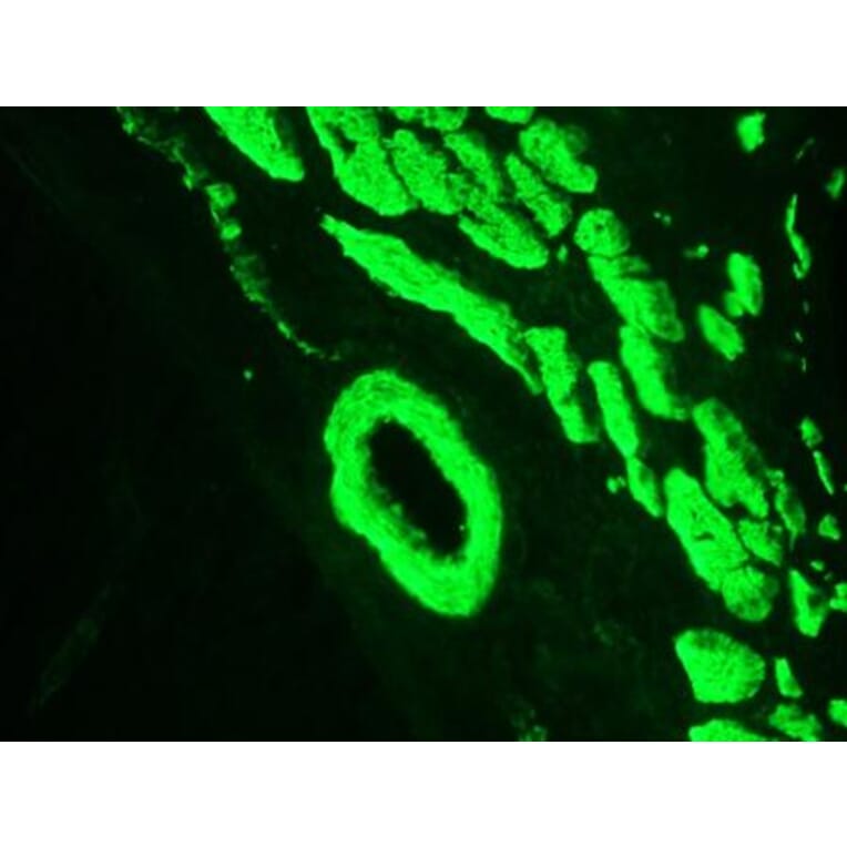 Immunohistochemistry - Anti-Smoothelin Antibody [R4A] (A115642) - Antibodies.com