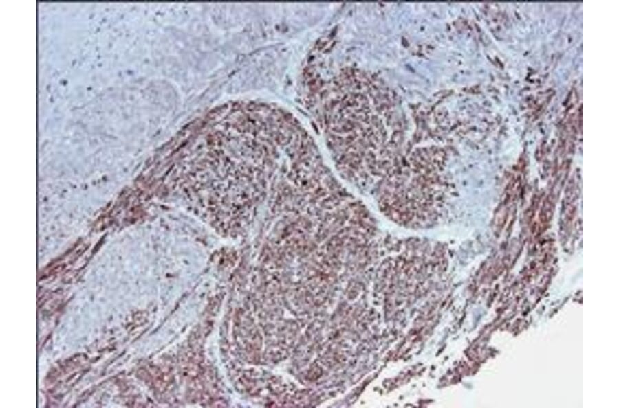 Immunohistochemistry - Anti-Smoothelin Antibody [R4A] (A115642) - Antibodies.com
