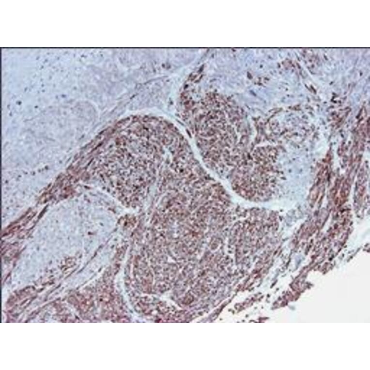 Immunohistochemistry - Anti-Smoothelin Antibody [R4A] (A115642) - Antibodies.com
